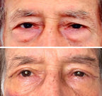 Creme Lifting Firmador Remover Rugas em 60 segundos original