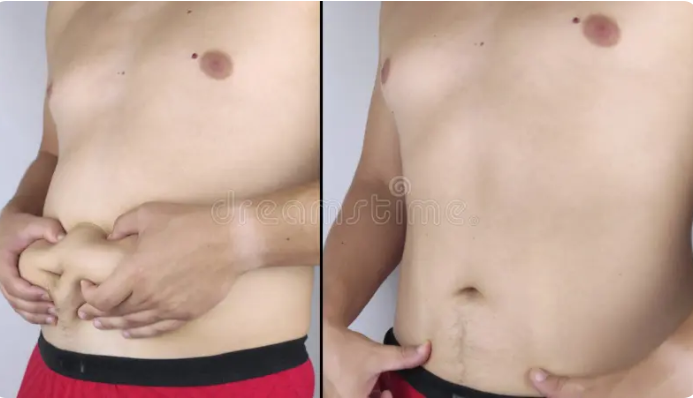 Adesivos de Moringa Emagrecedora