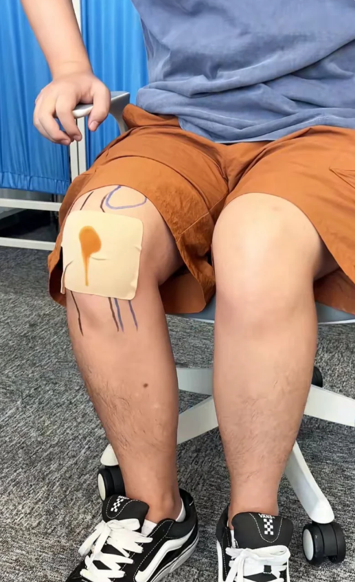 Fita Japonesa Alívio instantâneo DOROFF™